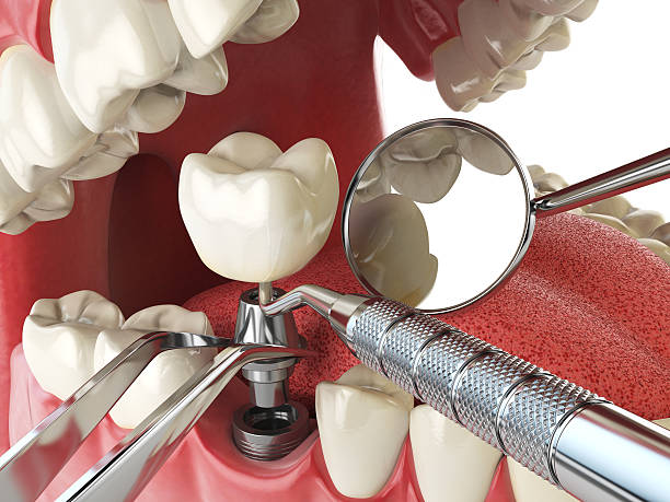 Best Broken Tooth Emergency  in Trussville, AL